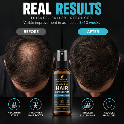 🔥BEST DEAL 80% OFF+ 🎁 Ultimate Men Hair Growth Spray